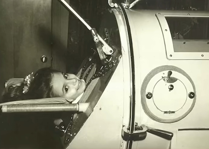Woman, 78, Last Polio Survivor Living In Iron Lung, Passes Away After Machine Becomes Too Old To Repair