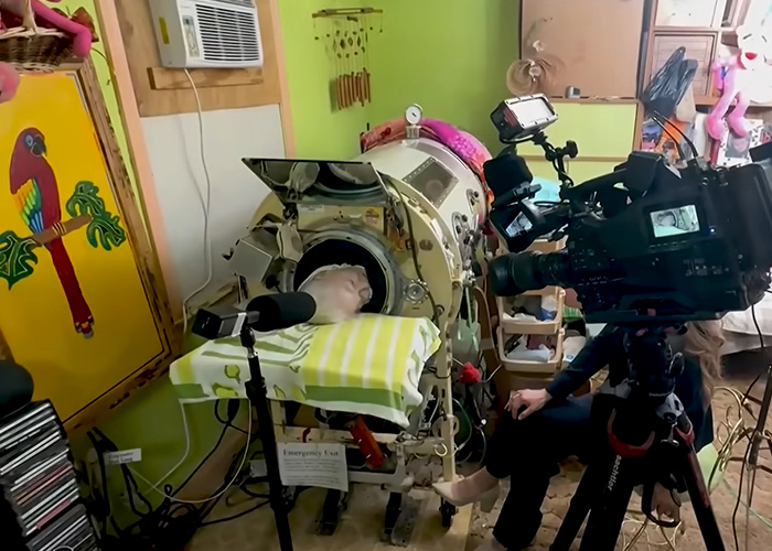 Woman, 78, Last Polio Survivor Living In Iron Lung, Passes Away After Machine Becomes Too Old To Repair