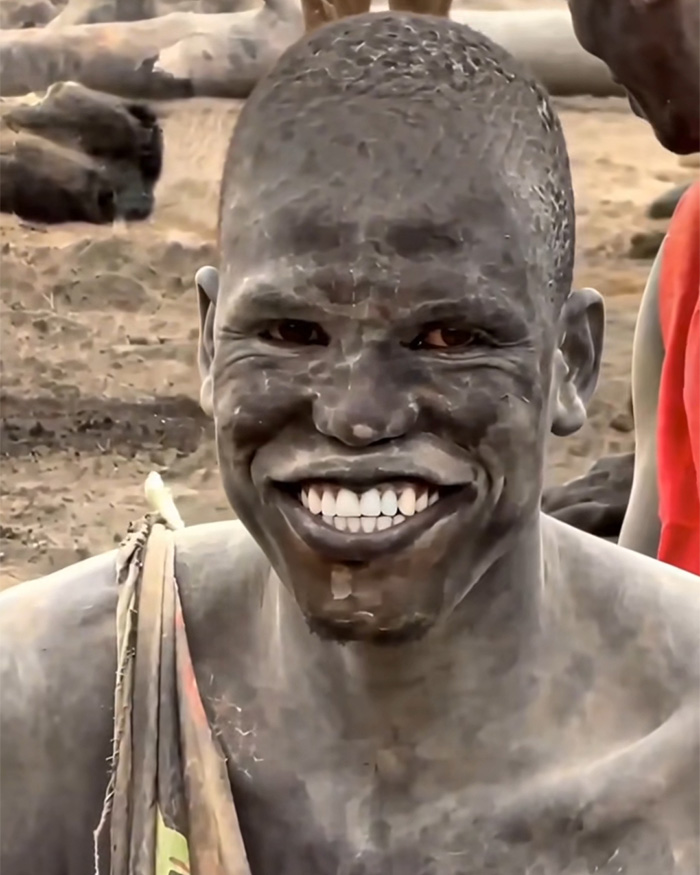 People Are Swapping Toothpaste For African Twig In Search Of A White Smile, Experts Reveal The Truth People Are Swapping Toothpaste For African Twig In Search Of A White Smile, Experts Reveal The Truth