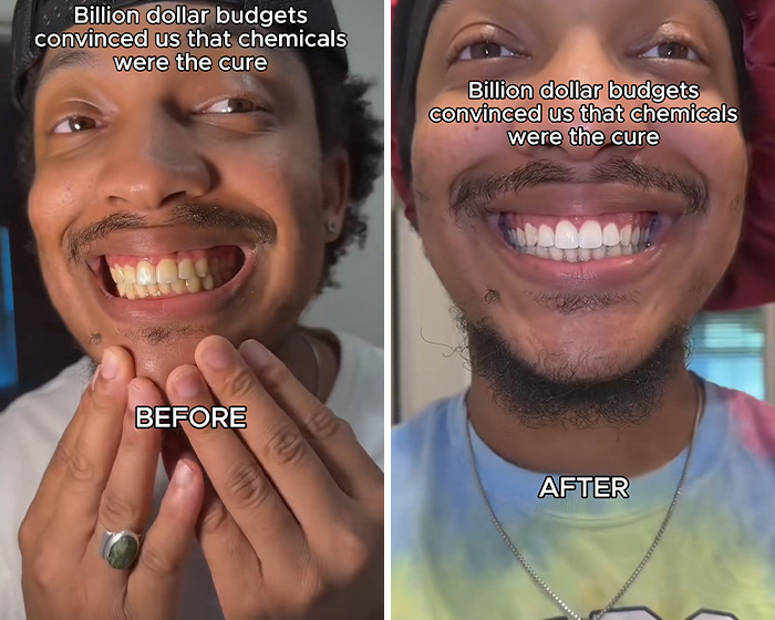 People Are Swapping Toothpaste For African Twig In Search Of A White Smile, Experts Reveal The Truth People Are Swapping Toothpaste For African Twig In Search Of A White Smile, Experts Reveal The Truth