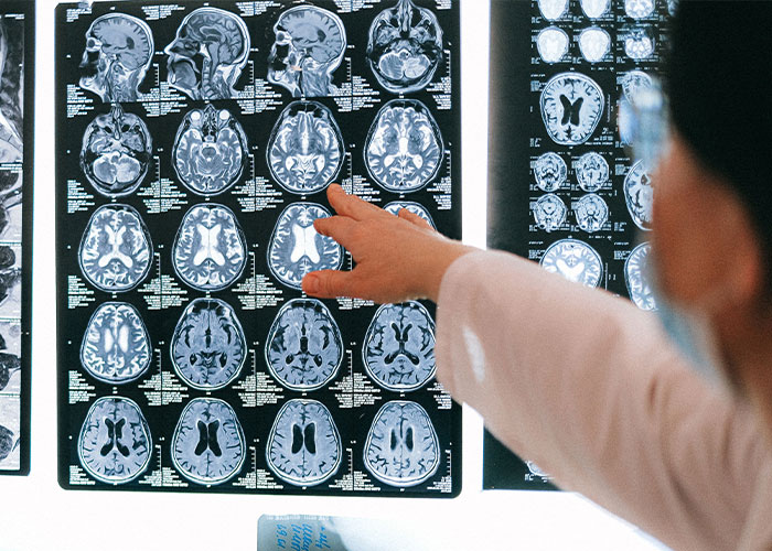 Experts Warn Of Commonly Dismissed Dementia Symptoms That Can Surface 15 Years Before Doctors Catch It Experts Warn Of Commonly Dismissed Dementia Symptoms That Can Surface 15 Years Before Doctors Catch It