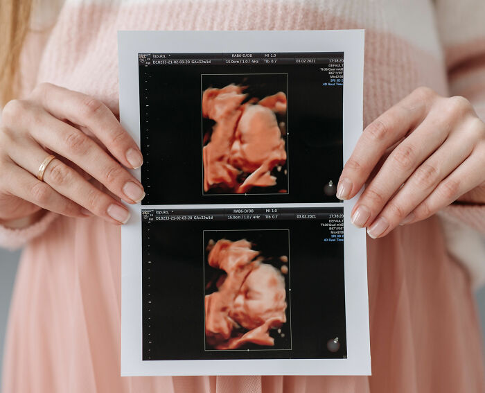 Gay Couple’s Surrogacy Journey Turns Into Ugly Feud After They Sue Woman Who Carried Their Son Gay Couple’s Surrogacy Journey Turns Into Ugly Feud After They Sue Woman Who Carried Their Son