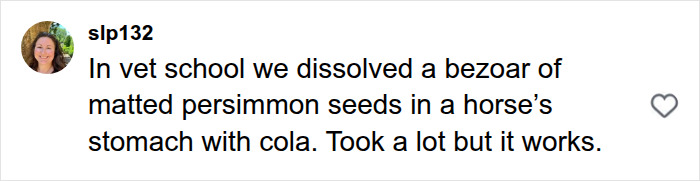 Woman&rsquo;s Stomach Condition Was Finally Cured After Doctors Said The Treatment Was Liters Of Diet Coke