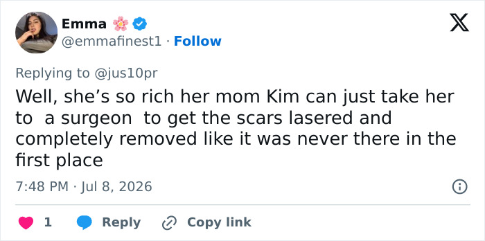 Kim Kardashian Slammed As Doctors Issue Grim Warning Over North West’s Hand Piercings: “Parents Don’t Care” Kim Kardashian Slammed As Doctors Issue Grim Warning Over North West’s Hand Piercings: “Parents Don’t Care”