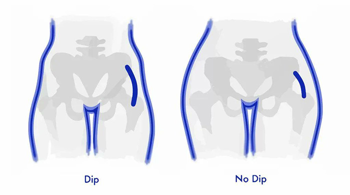 Men Are Refusing To Date Women With Hips Dips, Expert Reacts Men Are Refusing To Date Women With Hips Dips, Expert Reacts