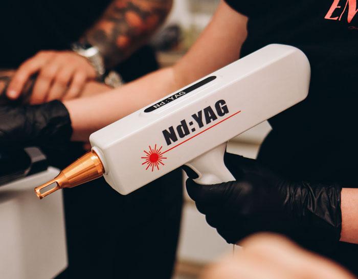 The Thing You Got Permanently Inked On Your Body At 19 Is Now A $1.5 Billion Regret Industry