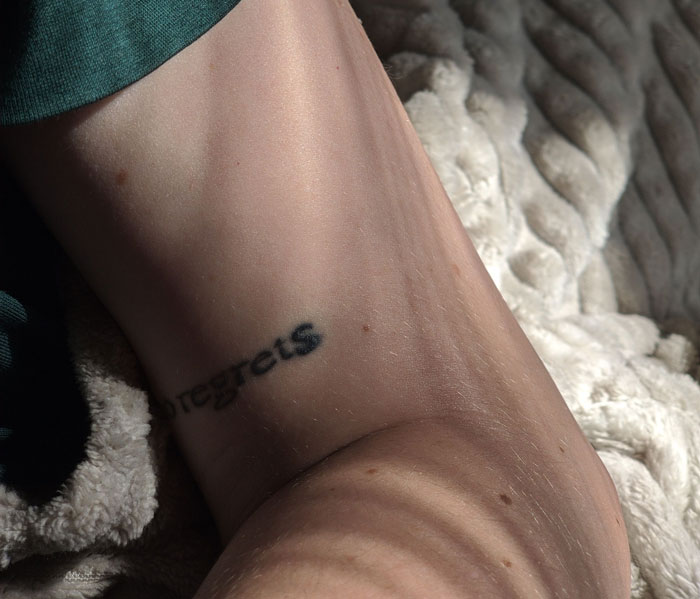 The Thing You Got Permanently Inked On Your Body At 19 Is Now A $1.5 Billion Regret Industry