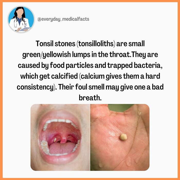 71 Medical Facts That Sound Fake But Are Completely Real 71 Medical Facts That Sound Fake But Are Completely Real