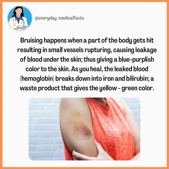 71 Medical Facts That Sound Fake But Are Completely Real 71 Medical Facts That Sound Fake But Are Completely Real