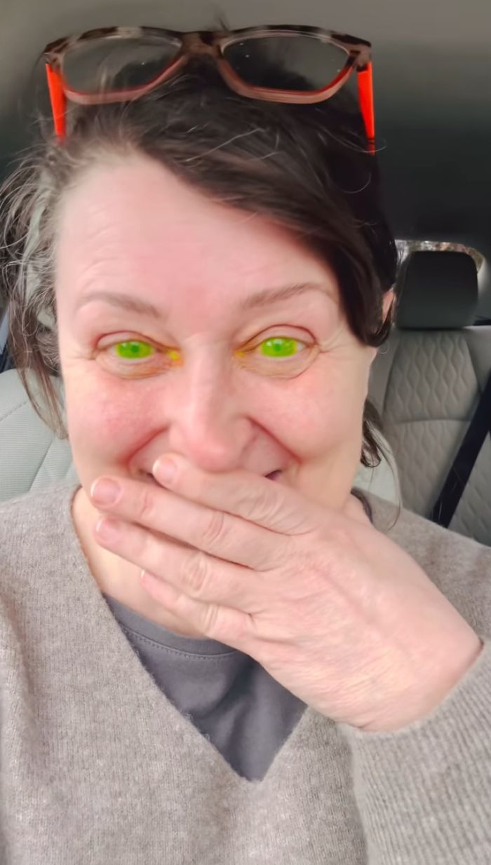 Woman Horrified After Her Pupils Turn Fluorescent Green During Routine Eye Exam, Experts Explain What Happened Woman Horrified After Her Pupils Turn Fluorescent Green During Routine Eye Exam, Experts Explain What Happened