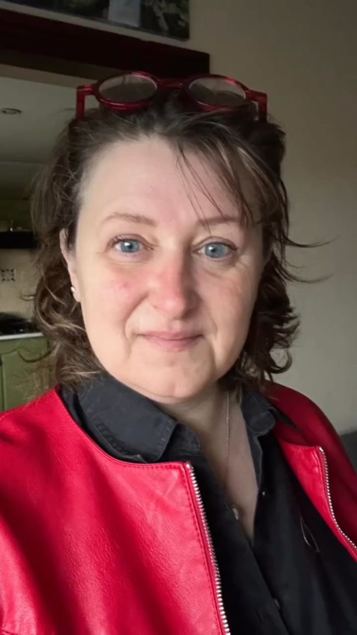 Woman Horrified After Her Pupils Turn Fluorescent Green During Routine Eye Exam, Experts Explain What Happened Woman Horrified After Her Pupils Turn Fluorescent Green During Routine Eye Exam, Experts Explain What Happened