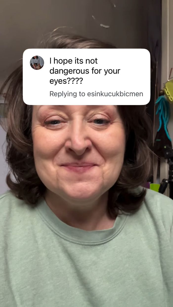 Woman Horrified After Her Pupils Turn Fluorescent Green During Routine Eye Exam, Experts Explain What Happened Woman Horrified After Her Pupils Turn Fluorescent Green During Routine Eye Exam, Experts Explain What Happened