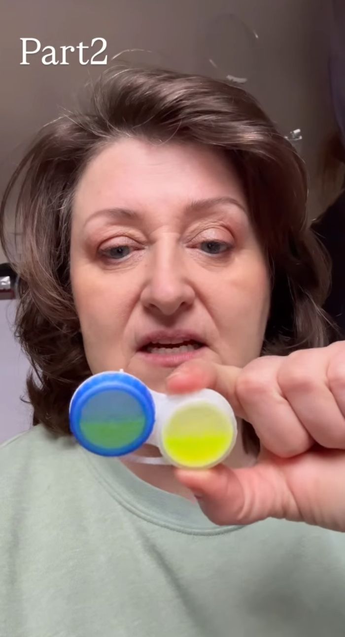 Woman Horrified After Her Pupils Turn Fluorescent Green During Routine Eye Exam, Experts Explain What Happened Woman Horrified After Her Pupils Turn Fluorescent Green During Routine Eye Exam, Experts Explain What Happened