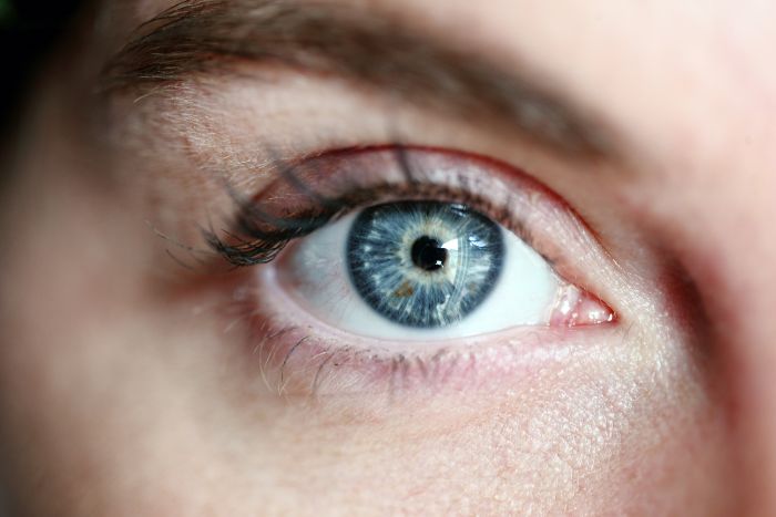 Woman Horrified After Her Pupils Turn Fluorescent Green During Routine Eye Exam, Experts Explain What Happened Woman Horrified After Her Pupils Turn Fluorescent Green During Routine Eye Exam, Experts Explain What Happened