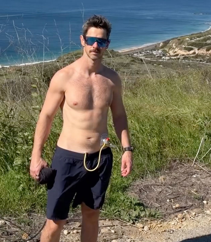 Man Reveals The Sad Struggles Of Hypospadias, Disease Affecting 15 Million Men