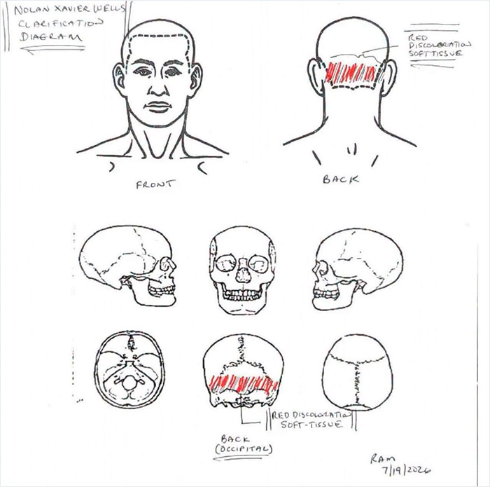 Preliminary Autopsy Results Released In Nolan Wells Case Raise Even More Questions