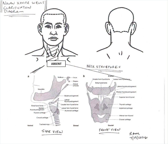 Preliminary Autopsy Results Released In Nolan Wells Case Raise Even More Questions