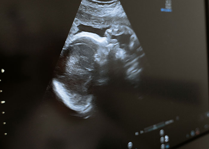 &ldquo;Blew My Frickin&rsquo; Mind&rdquo;: 46 Facts About The Human Body That Impressed Medical Students