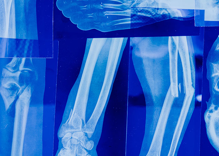 &ldquo;Blew My Frickin&rsquo; Mind&rdquo;: 46 Facts About The Human Body That Impressed Medical Students