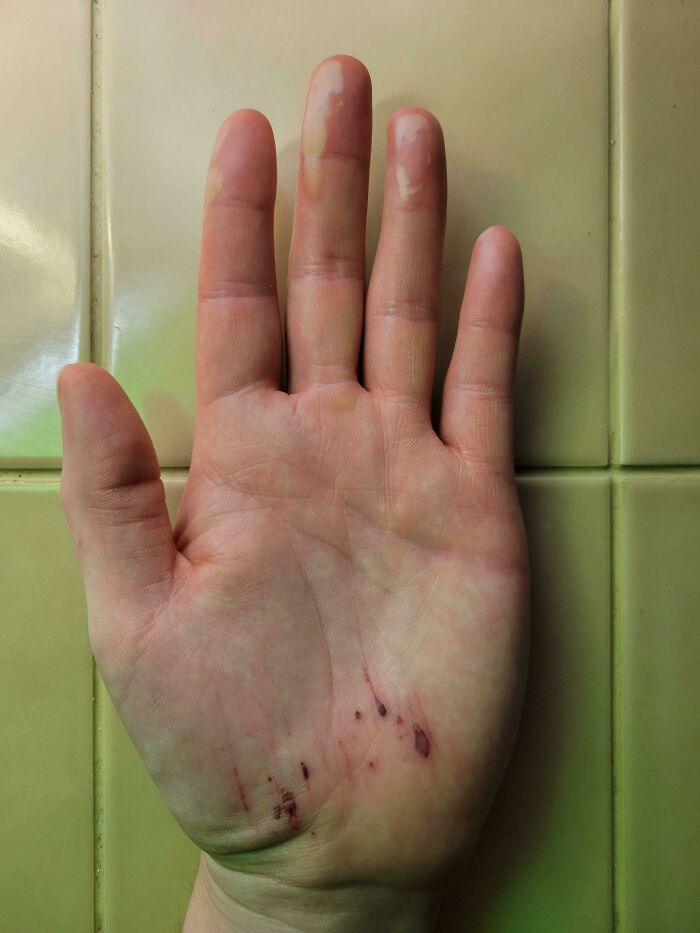 87 People Who Are Having A Way Worse Day Than You