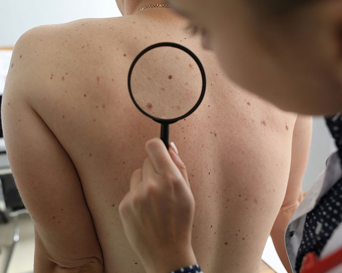 Dermatologist Reveals The Major Red Flag On Your Skin That Could Signal Heart Problems Dermatologist Reveals The Major Red Flag On Your Skin That Could Signal Heart Problems