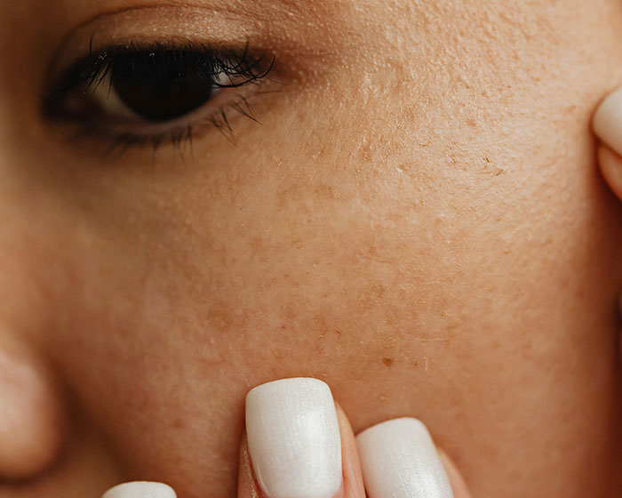 Dermatologist Reveals The Major Red Flag On Your Skin That Could Signal Heart Problems Dermatologist Reveals The Major Red Flag On Your Skin That Could Signal Heart Problems