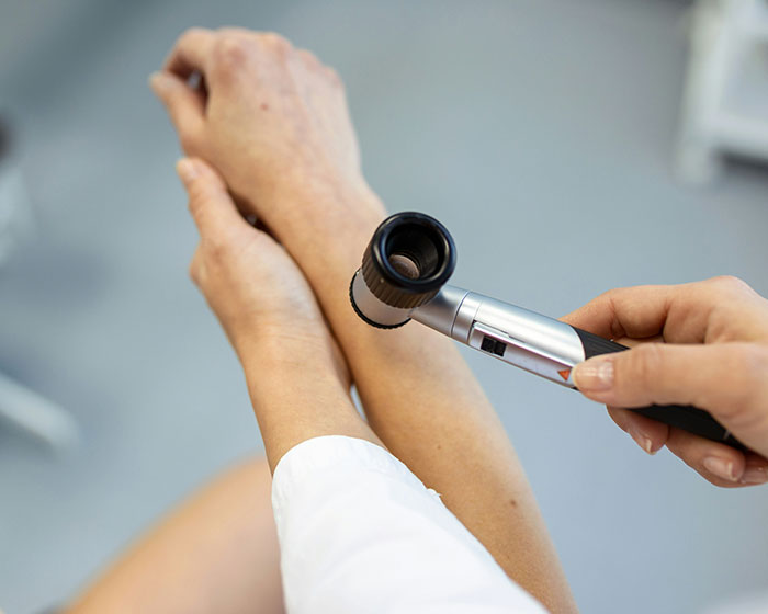 Dermatologist Reveals The Major Red Flag On Your Skin That Could Signal Heart Problems Dermatologist Reveals The Major Red Flag On Your Skin That Could Signal Heart Problems