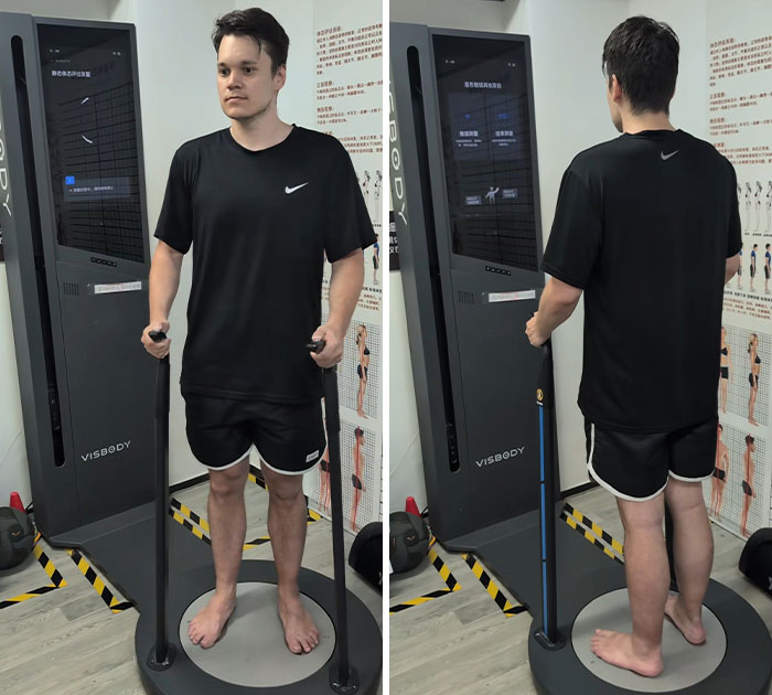 Man Reveals Wild Before-And-After After Attending Chinese “Fat Camp” For Four Weeks