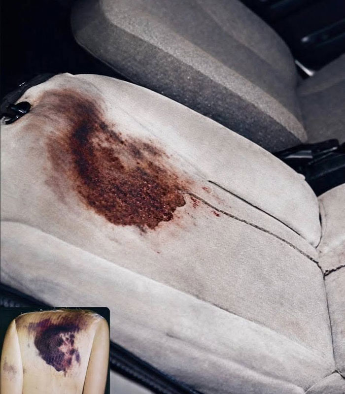 20YO Man Disappeared Until A Boy Noticed A Stray Dog Carrying Something That Revealed His Horrific Fate