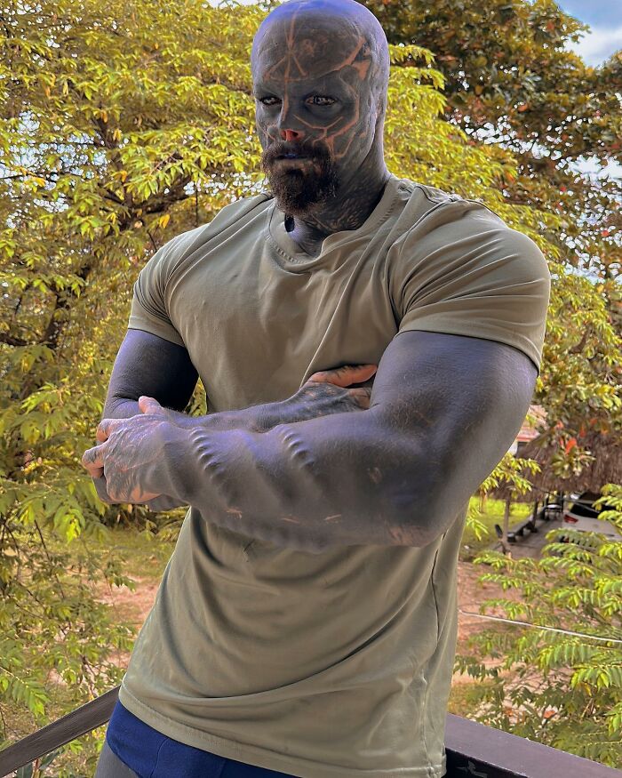 Man Gives Up His Nose, Ears And Fingers To Become A “Black Alien,” Shocked It Costs Him His Career Man Gives Up His Nose, Ears And Fingers To Become A “Black Alien,” Shocked It Costs Him His Career
