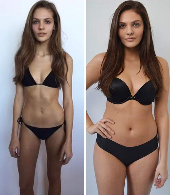 15 Empowering Weight Gain Transformations By Women, As Experts Share Tips 15 Empowering Weight Gain Transformations By Women, As Experts Share Tips