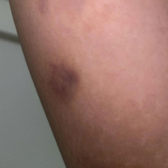 &ldquo;People Are Injecting First And Asking Questions Later&rdquo;: Experts Warn Of A Black-Market Peptide Craze Slipping Out Of Control