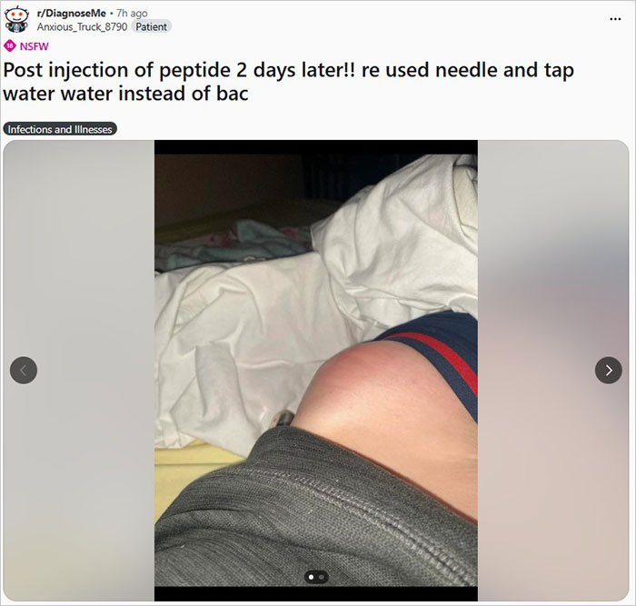 &ldquo;People Are Injecting First And Asking Questions Later&rdquo;: Experts Warn Of A Black-Market Peptide Craze Slipping Out Of Control