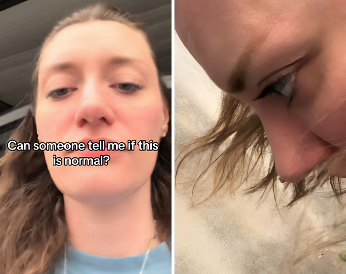 Woman Asks For Help After Noticing Bizarre Issue When Bending Over, Many Desperately Respond Woman Asks For Help After Noticing Bizarre Issue When Bending Over, Many Desperately Respond