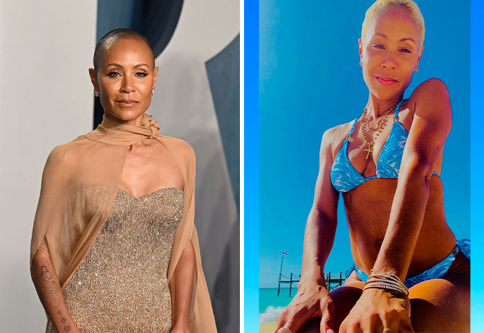 6 Celebrities Who Confessed To Having Cosmetic Procedures On Their “Lady Bits”, As Doctor Reveals Risks 6 Celebrities Who Confessed To Having Cosmetic Procedures On Their “Lady Bits”, As Doctor Reveals Risks