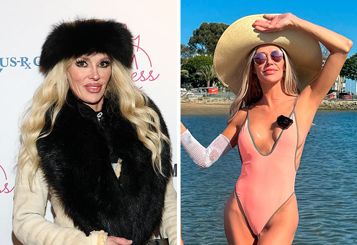 6 Celebrities Who Confessed To Having Cosmetic Procedures On Their “Lady Bits”, As Doctor Reveals Risks 6 Celebrities Who Confessed To Having Cosmetic Procedures On Their “Lady Bits”, As Doctor Reveals Risks