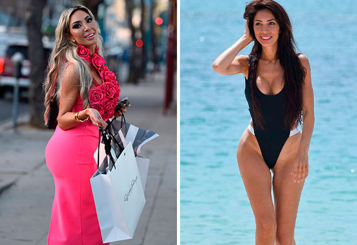 6 Celebrities Who Confessed To Having Cosmetic Procedures On Their “Lady Bits”, As Doctor Reveals Risks 6 Celebrities Who Confessed To Having Cosmetic Procedures On Their “Lady Bits”, As Doctor Reveals Risks