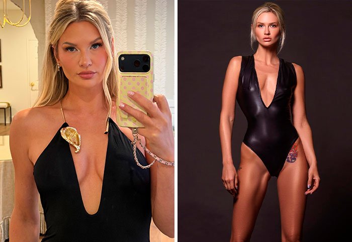 6 Celebrities Who Confessed To Having Cosmetic Procedures On Their “Lady Bits”, As Doctor Reveals Risks 6 Celebrities Who Confessed To Having Cosmetic Procedures On Their “Lady Bits”, As Doctor Reveals Risks