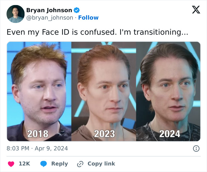 Multimillionaire Biohacker Bryan Johnson Shocks Fans As He Reveals He “Cloned Himself As A Baby” Multimillionaire Biohacker Bryan Johnson Shocks Fans As He Reveals He “Cloned Himself As A Baby”