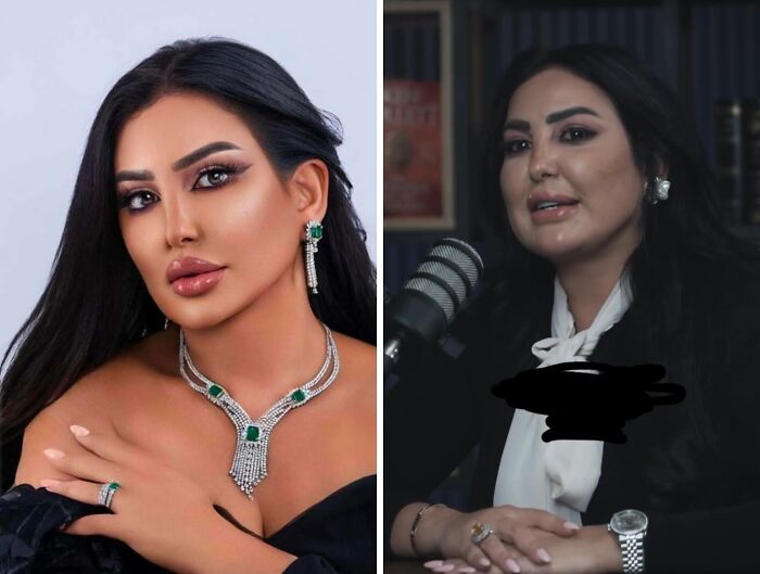 “Can’t Tell If This Is A Joke Or Not”: 80 People Who Didn’t Even Try To Look Natural On Social Media (New Pics) “Can’t Tell If This Is A Joke Or Not”: 80 People Who Didn’t Even Try To Look Natural On Social Media (New Pics)