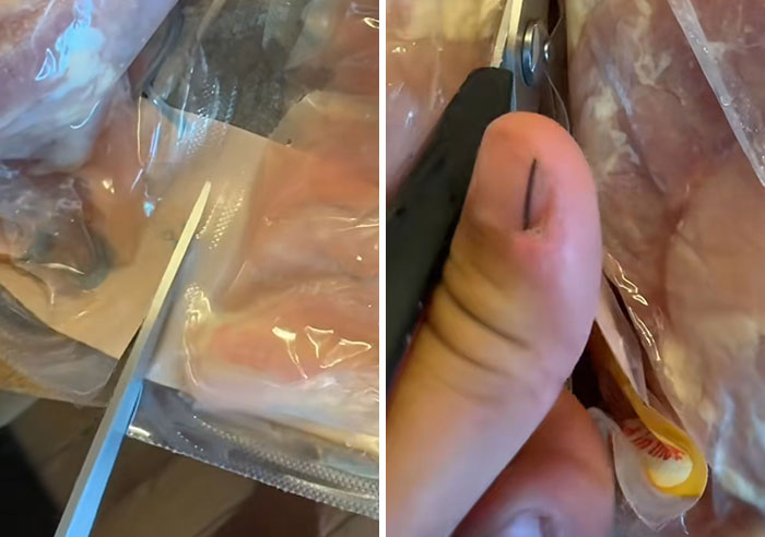 Man’s Viral Costco Chicken Clip Sparks Concern As Viewers Notice Dark Nail Stripe, Expert Explains What It Means Man’s Viral Costco Chicken Clip Sparks Concern As Viewers Notice Dark Nail Stripe, Expert Explains What It Means