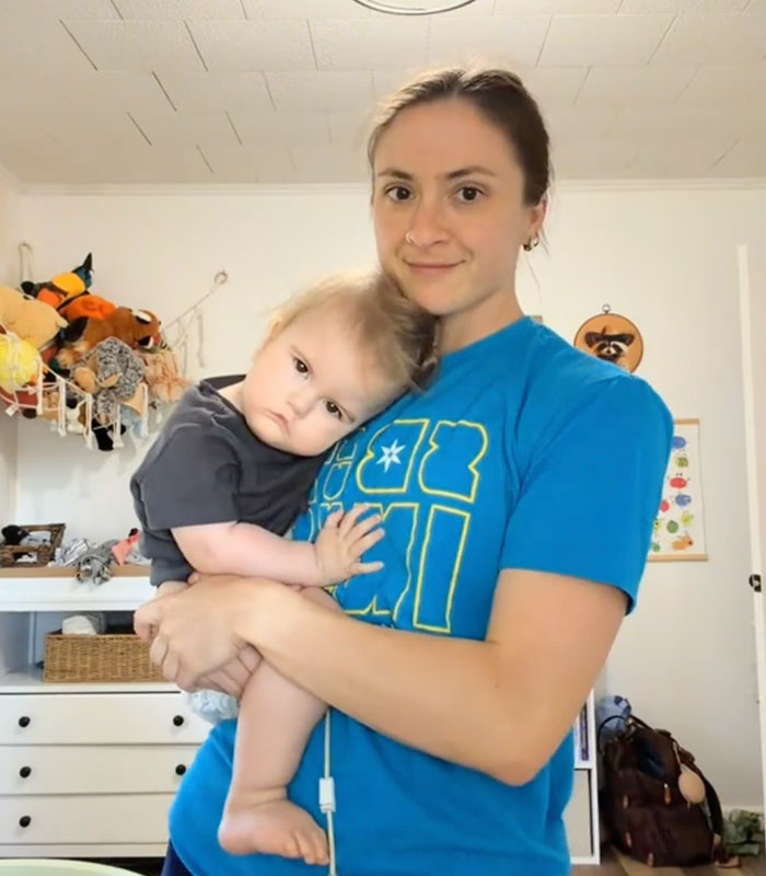 Mom Knew Something Was Wrong When Her Baby Couldn’t Form Expressions, Then Doctors Discovered A Rare Condition Mom Knew Something Was Wrong When Her Baby Couldn’t Form Expressions, Then Doctors Discovered A Rare Condition