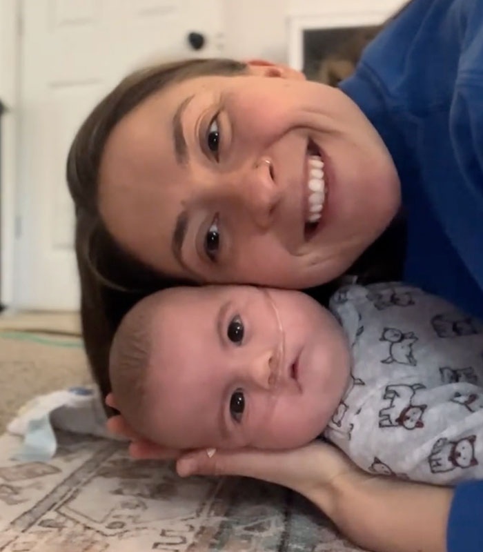 Mom Knew Something Was Wrong When Her Baby Couldn’t Form Expressions, Then Doctors Discovered A Rare Condition Mom Knew Something Was Wrong When Her Baby Couldn’t Form Expressions, Then Doctors Discovered A Rare Condition