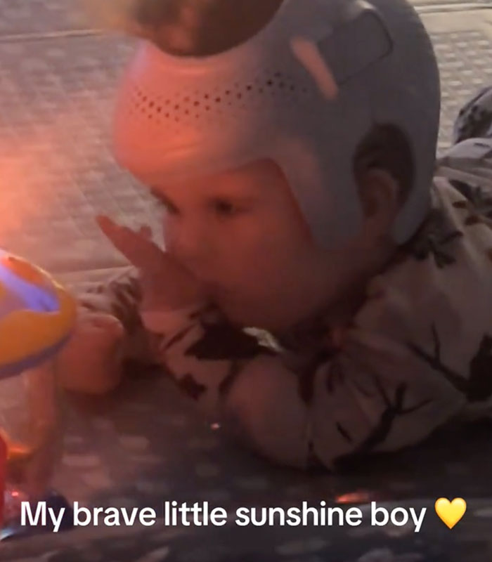 Mom Knew Something Was Wrong When Her Baby Couldn’t Form Expressions, Then Doctors Discovered A Rare Condition Mom Knew Something Was Wrong When Her Baby Couldn’t Form Expressions, Then Doctors Discovered A Rare Condition