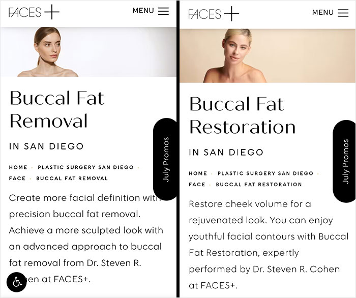 After Anya Taylor-Joy Seemingly Went Back On Her Buccal Fat Removal, Expert Weighs In On Reversal Procedure After Anya Taylor-Joy Seemingly Went Back On Her Buccal Fat Removal, Expert Weighs In On Reversal Procedure