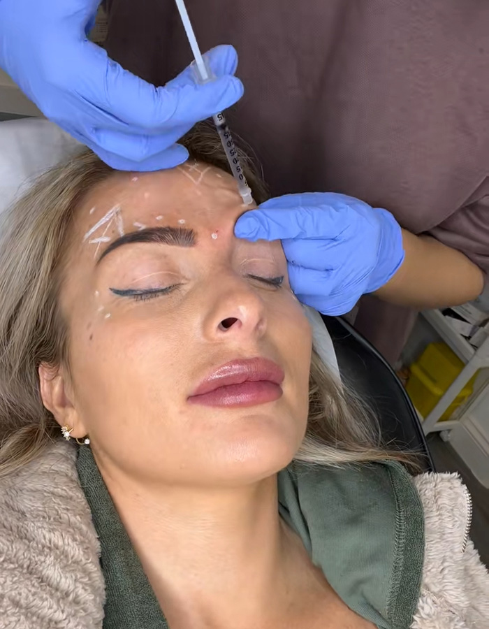 Identical Twins Show Dramatic Differences After One Uses Botox For 20 Years And The Other Doesn’t Identical Twins Show Dramatic Differences After One Uses Botox For 20 Years And The Other Doesn’t
