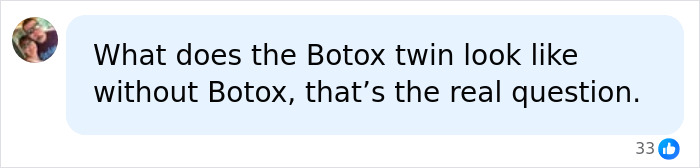 Identical Twins Show Dramatic Differences After One Uses Botox For 20 Years And The Other Doesn’t Identical Twins Show Dramatic Differences After One Uses Botox For 20 Years And The Other Doesn’t