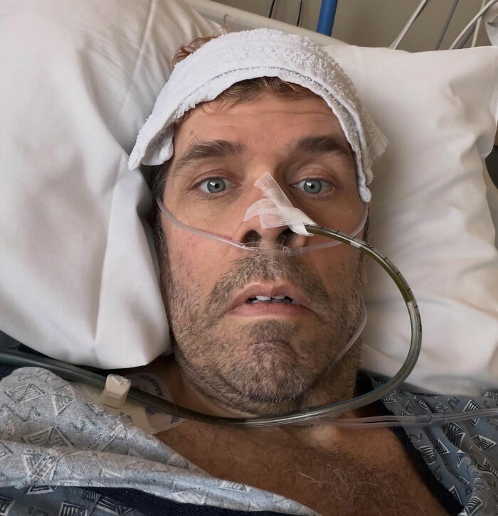 Perez Hilton’s Team Reveals He Suffered Significant Injuries And Will Need A Surgery In Coming Days Perez Hilton’s Team Reveals He Suffered Significant Injuries And Will Need A Surgery In Coming Days
