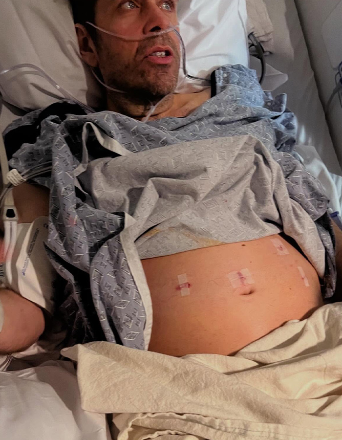 Perez Hilton’s Team Reveals He Suffered Significant Injuries And Will Need A Surgery In Coming Days Perez Hilton’s Team Reveals He Suffered Significant Injuries And Will Need A Surgery In Coming Days