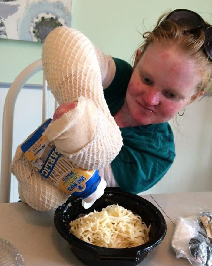 Woman With One Of The World’s Rarest Skin Conditions Details Extreme Measures To Protect Herself Woman With One Of The World’s Rarest Skin Conditions Details Extreme Measures To Protect Herself